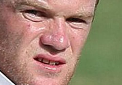 The 20 Ugliest Footballers in the World: Who are They?